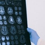 Medical professional examining a brain MRI scan, representing research on brain health and cognition.
