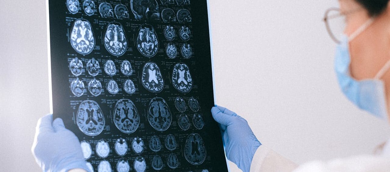 The Brain-Loving Science Behind the Mediterranean Keto Diet