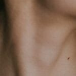 Close-up of a woman’s neck and jawline illustrating sagging skin before firming treatment.